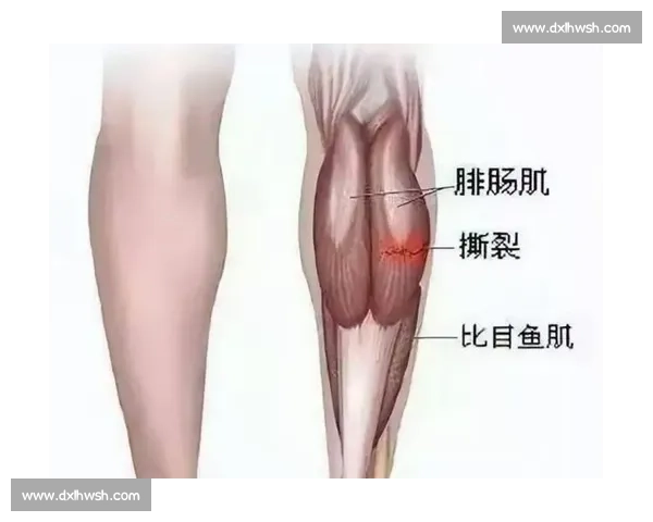 肌肉拉伤的预防方法与康复训练全攻略
